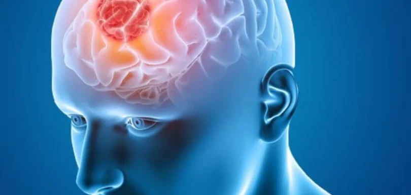 tumor cerebral - Best Nephrology Hospital in Gurgaon