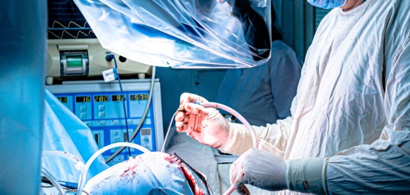 Laser Kidney Stone Surgery in Gurgaon